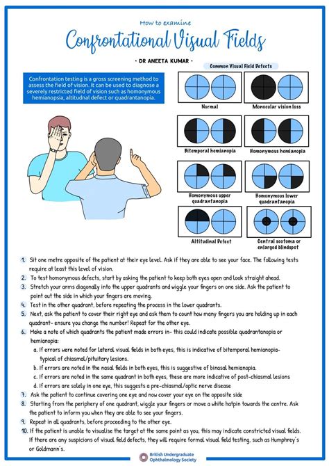 Confrontation Visual Fields .